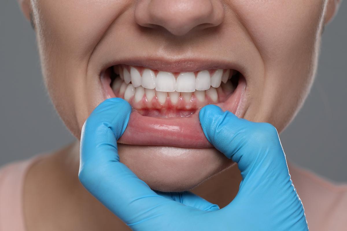 Woman showing healthy gums